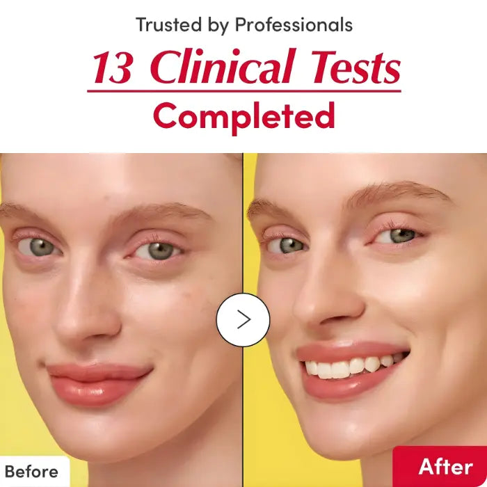 سيروم تفتيح البشرة من إيكوالبيري مع فيتامين سي [30 مل]