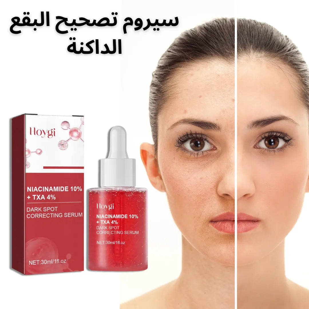 مصل HOYGI™ لتفتيح البشرة وإصلاح البقع الداكنة