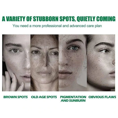 EELHOE™ Dark Spot & Acne Mark Fade Brightening Serum – 50ml